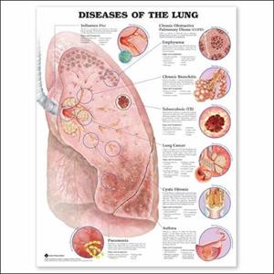 Peri Bronchial Coughing - Bronchitis In Children - 20 Must Know Facts For Parents