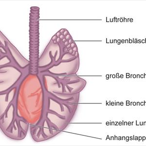 Bronchitis Erkrankung 