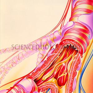 Bronchitis And Coughing - Chronic Bronchitis And Emphysema