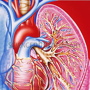 Bronchitis Drug Treatment - Heart Disease, Lung Cancer And COPD - The 3 Causes Of Death