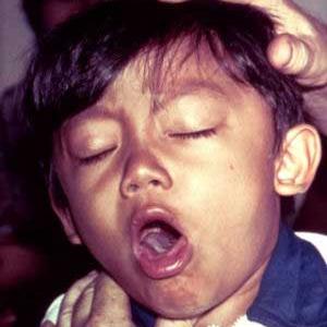  Cough Causes Symptoms Information With Treatment