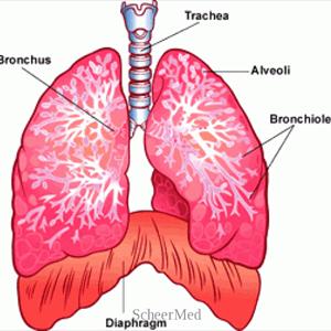 Allergische Bronchitis 